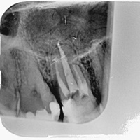 Chirurgia stomatologia Radom