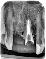 Endodoncja Radom ul. Zakręt 6