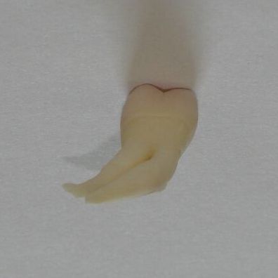 Endodoncja Radom