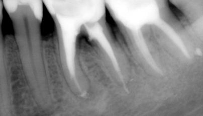 Endodoncja Radom