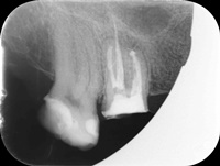 Endodoncja Radom ul. Zakręt 6