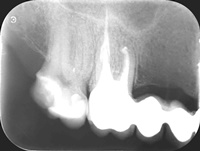 Endodoncja Radom ul. Zakręt 6